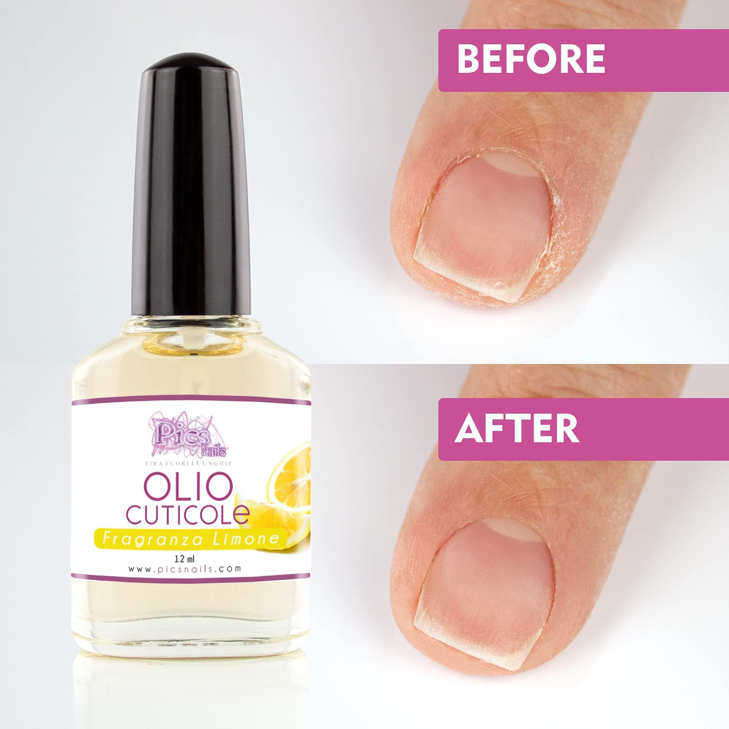 Olio Cuticole Unghie Di Mani E Piedi Professionale 12Ml - Fragranza Limone - Olio Idratante E Rigenerante per Cuticole Di Mani E Piedi, Dona Sollievo E Freschezza Alla Pelle Secca E Irritate