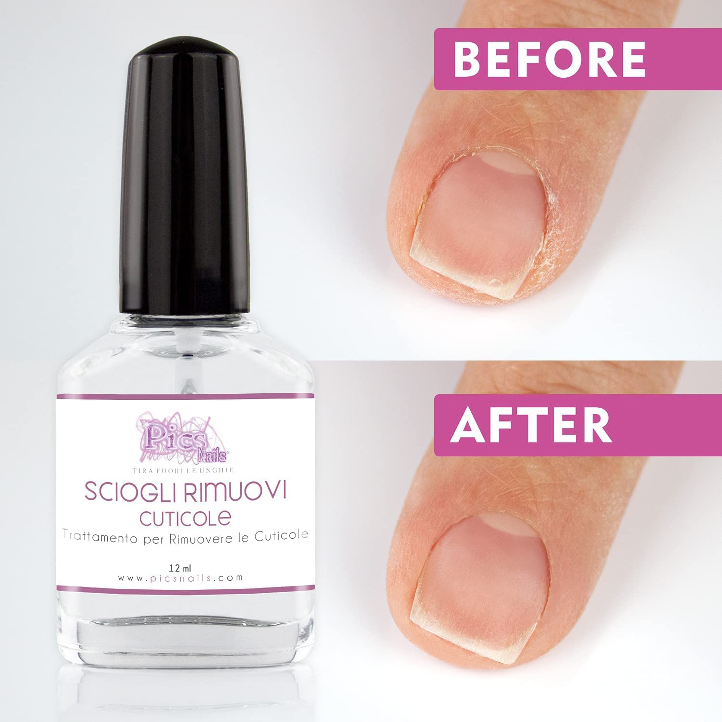 Rimuovi Cuticole Unghie Di Mani E Piedi Professionale 12 Ml - Scioglie E Rimuove Cuticole Trattamento per Unghie Di Mani E Piedi