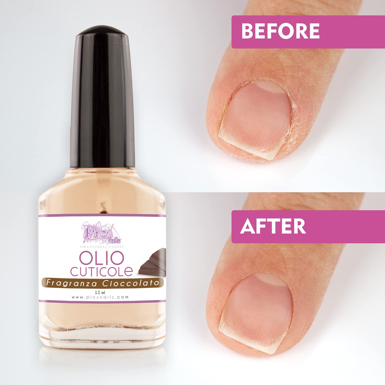 Olio Cuticole Unghie Di Mani E Piedi Professionale 12Ml - Fragranza Cioccolato - Olio Idratante E Rigenerante per Cuticole Di Mani E Piedi, Dona Sollievo E Freschezza Alla Pelle Secca E Irritata