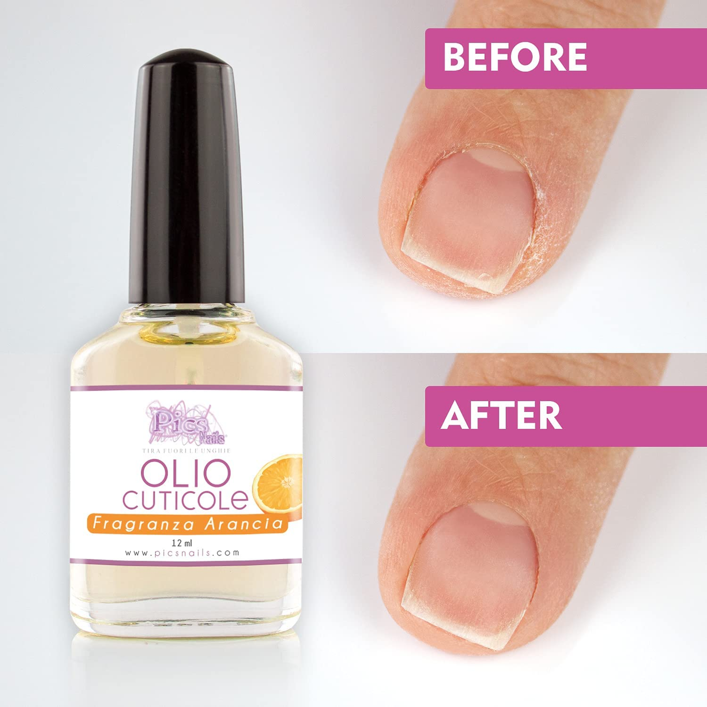 Olio Cuticole Di Mani E Piedi Professionale 12Ml - Fragranza Arancia - Olio Idratante E Rigenerante per Cuticole Di Mani E Piedi, Dona Sollievo E Freschezza Alla Pelle Secca E Irritata