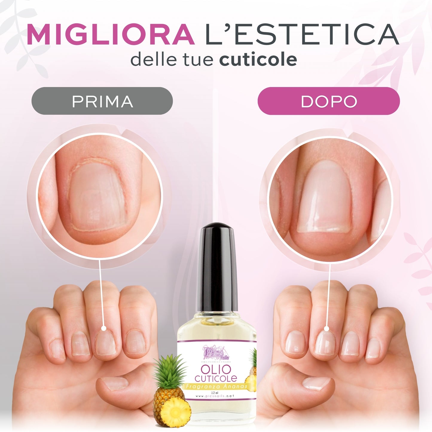 Olio Cuticole Unghie per Mani E Piedi Professionale Ananas 12 ml