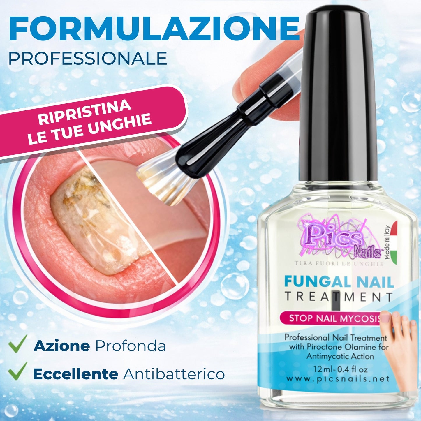 Antimicotico Unghie 12 ml - Trattamento della Micosi Unghie di Mani e Piedi
