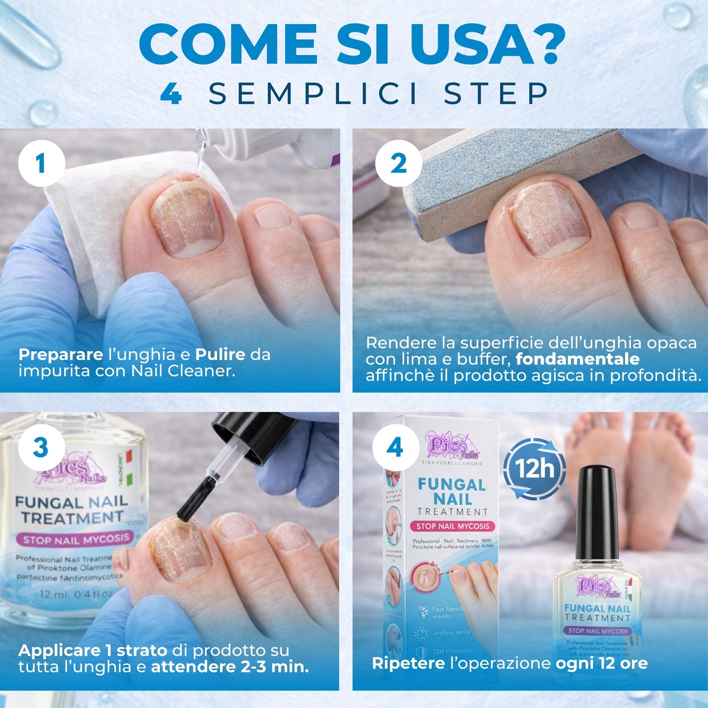 Antimicotico Unghie 12 ml - Trattamento della Micosi Unghie di Mani e Piedi